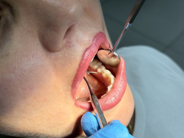 Новый стоматолог-ортодонт в Бутово: исправление прикуса и эстетика улыбки в «Здоровой системе»