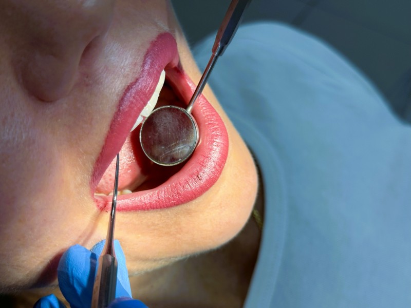 Прием стоматолога