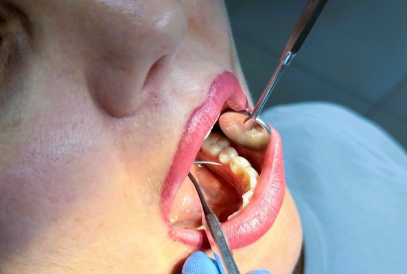 Теперь в Бутово: комплексное лечение у стоматолога-ортодонта