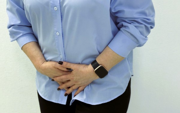 Обильные месячные (гиперменорея)