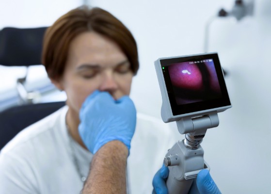 Аллергический ринит (насморк)